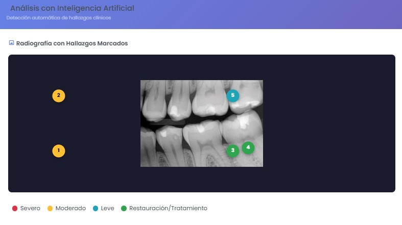 IA para diagnósticos en ClinicLin